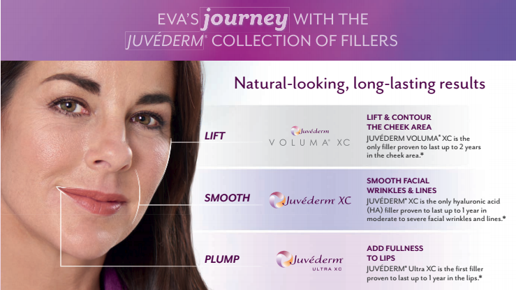 JUVÉDERM® Collection of Fillers